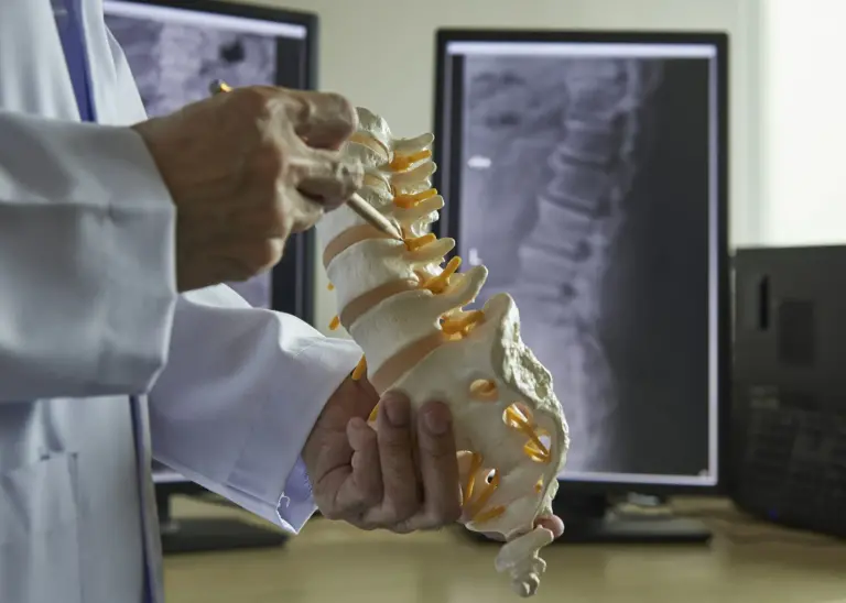 chiorpractor xrays spine axis health center saskatoon physiotherapy subluxation degenerative disc disease