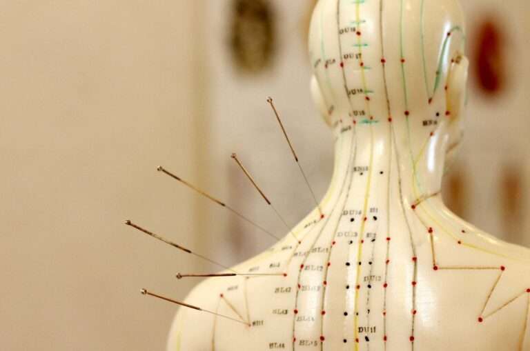 axis health center acupuncture dry needling saskatoon